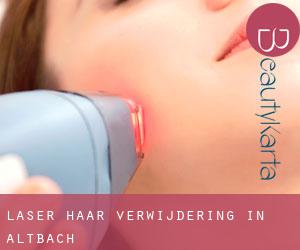 Laser haar verwijdering in Altbach