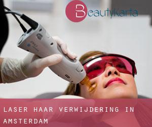 Laser haar verwijdering in Amsterdam