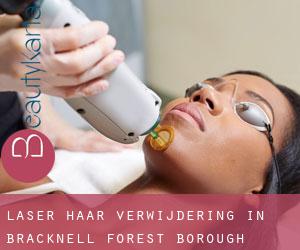 Laser haar verwijdering in Bracknell Forest (Borough)