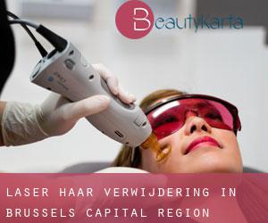 Laser haar verwijdering in Brussels Capital Region