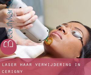 Laser haar verwijdering in Cérigny