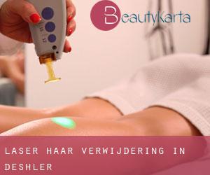 Laser haar verwijdering in Deshler