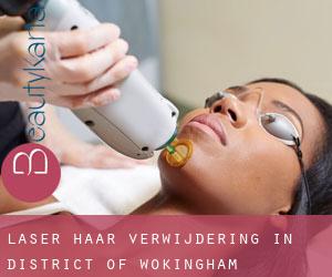 Laser haar verwijdering in District of Wokingham