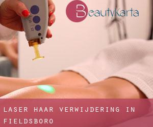 Laser haar verwijdering in Fieldsboro