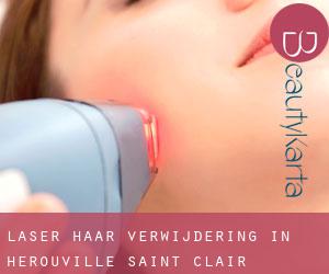 Laser haar verwijdering in Hérouville-Saint-Clair