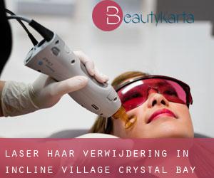 Laser haar verwijdering in Incline Village-Crystal Bay