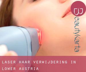 Laser haar verwijdering in Lower Austria