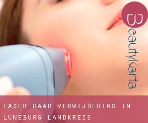 Laser haar verwijdering in Lüneburg Landkreis