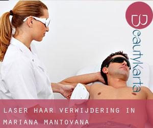 Laser haar verwijdering in Mariana Mantovana