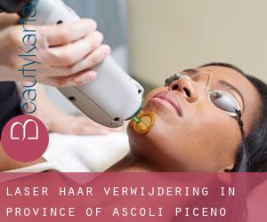 Laser haar verwijdering in Province of Ascoli Piceno