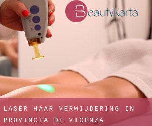 Laser haar verwijdering in Provincia di Vicenza