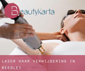 Laser haar verwijdering in Reedley