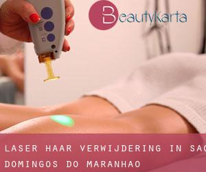 Laser haar verwijdering in São Domingos do Maranhão