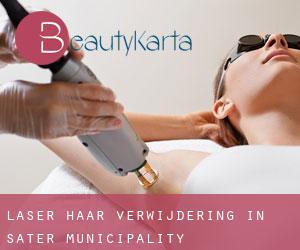 Laser haar verwijdering in Säter Municipality