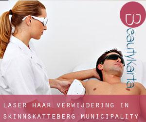 Laser haar verwijdering in Skinnskatteberg Municipality