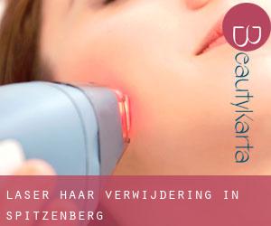 Laser haar verwijdering in Spitzenberg Laser haar verwijdering in Spitzenberg