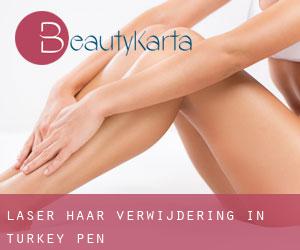 Laser haar verwijdering in Turkey Pen