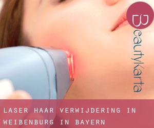 Laser haar verwijdering in Weißenburg in Bayern