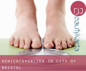 Gewichtsverlies in City of Bristol