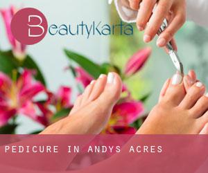 Pedicure in Andys Acres
