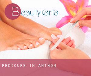 Pedicure in Anthon