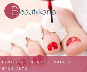 Pedicure in Apple Valley Highlands