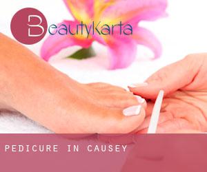 Pedicure in Causey