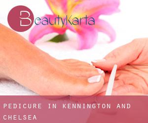 Pedicure in Kennington and Chelsea